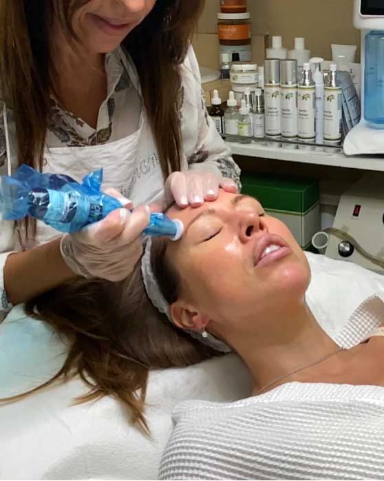 Micro-Channeling / Microneedling